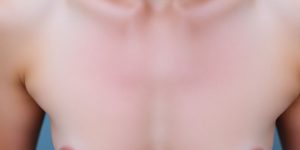 Woman's smooth skin with fading dark spots.